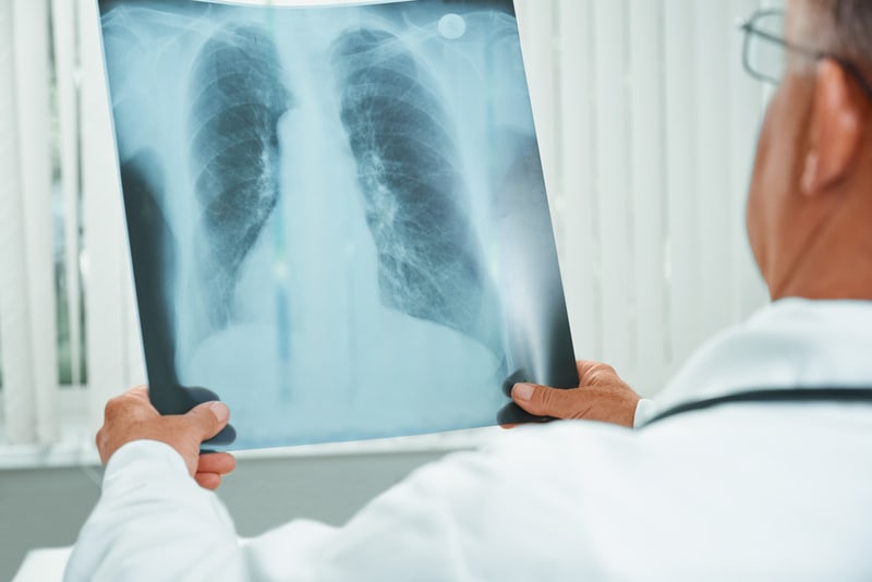 Unrecognizable older man doctor examines x-ray image of lungs in a hospital